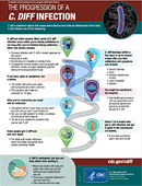 Thumbnail image of PDF: The Progression of a C. diff Infection